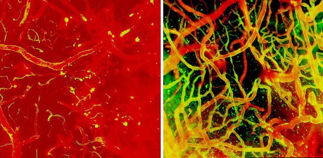 t day 1 after injury (left panel), the brain had areas of bleeding and broken vessels. Ten days later (right panel) the vessels were almost completely rebuilt.