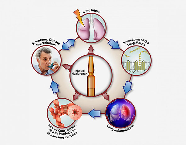 diagram showing how inhaling hyaluronan interferes at almost every step of the COPD cycle, making it a potent treatment for chronic lung disease