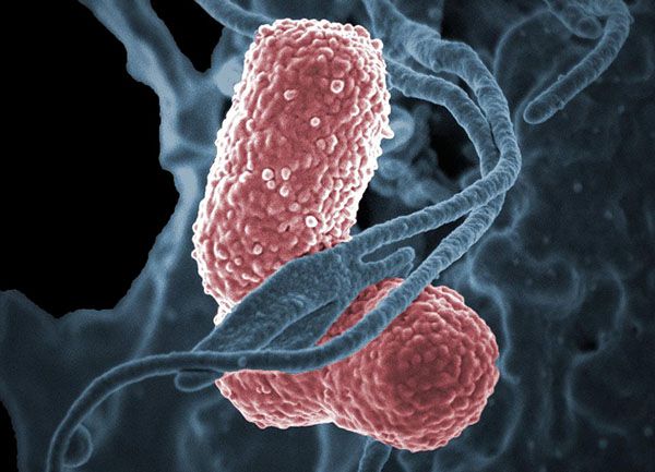 Colorized scanning electron micrograph showing carbapenem-resistant Klebsiella pneumoniae interacting with a human neutrophil