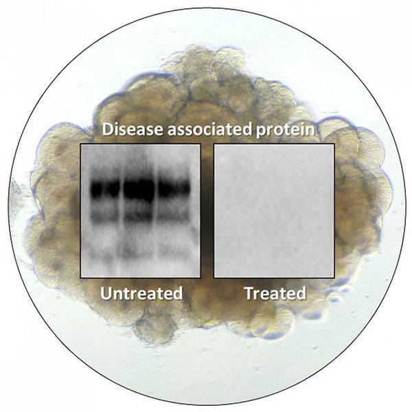 A cerebral organoid shown overlaid with test results from prion infected organoids that were left untreated or treated with PPS