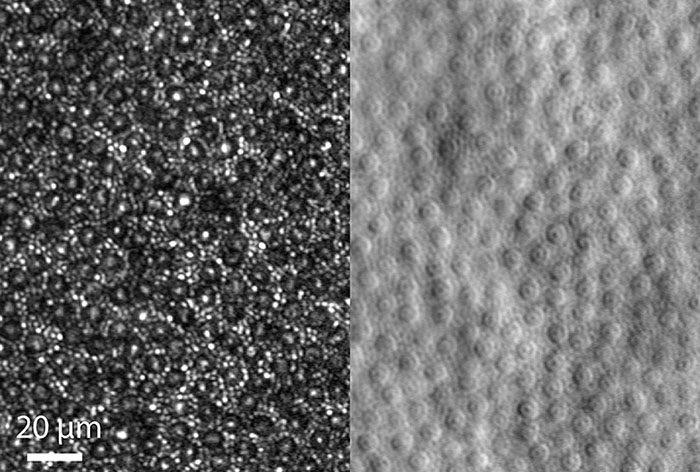 The mosaic of cone and rod photoreceptor cells is shown by confocal imaging (left) and split detection.