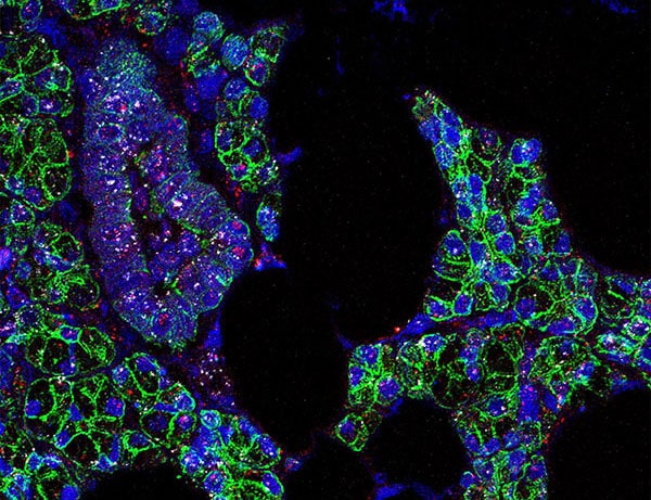 RNA for SARS-CoV-2 (pink) and the ACE2 receptor (white) was found in salivary gland cells, which are outlined in green