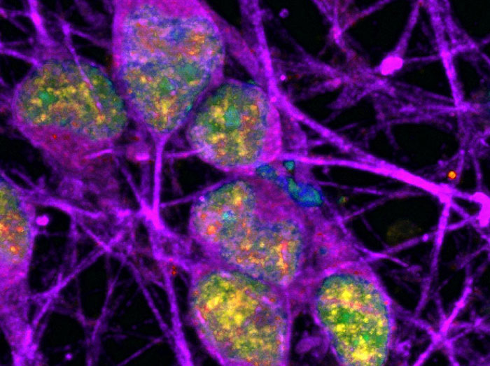 Neurons (labeled in purple) show signs of an active DNA repair process (labeled in yellow). The cells’ DNA itself is labeled in cyan (in this image, overlap between cyan and yellow appears green).