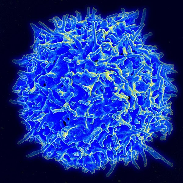 Scanning electron micrograph of a human T lymphocyte (also called a T cell) from the immune system of a healthy donor