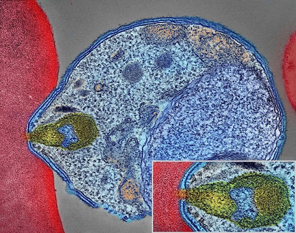 Colorized electron micrograph showing malaria parasite (right, blue) attaching to a human red blood cell. The inset shows a detail of the attachment point at higher magnification