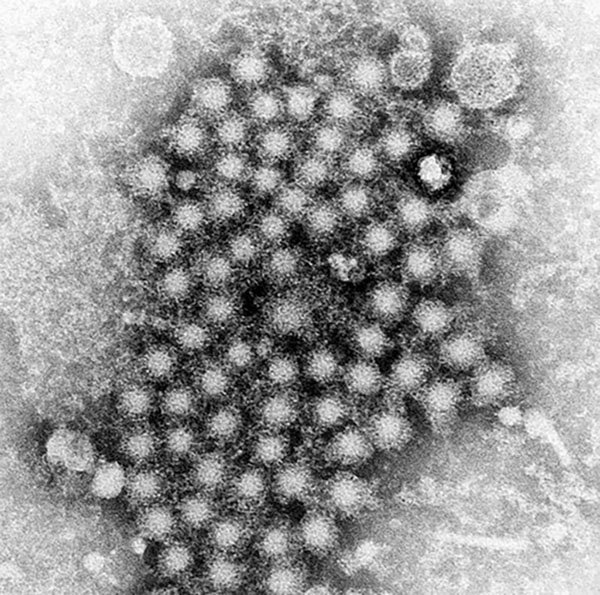 A transmission electron microscopic image of hepatitis virus particles