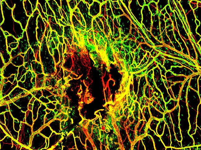 Seven days after mTBI, the blood vessels (stained in red) in the tissues around the brain are not completely repaired. A marker for intact vessels was used (labeled in green) to distinguish fully functional blood vessels (yellow) from ones that are still damaged (red).