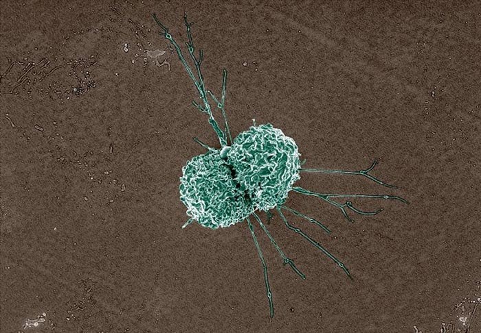 Colorized scanning electron micrograph of a macrophage