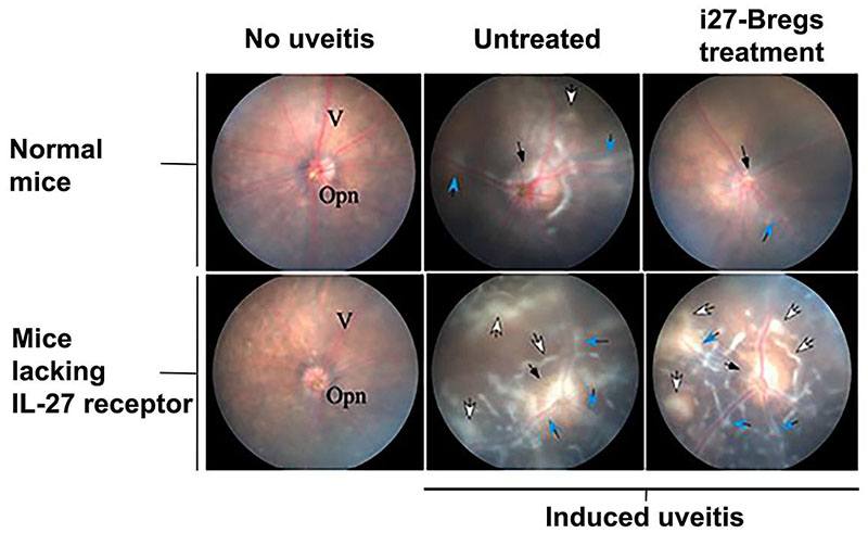Photographs of mouse retina showing the effect of uveitis treatment with i27-Bregs
