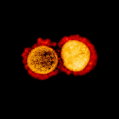 two SARS-CoV-2 virus particles