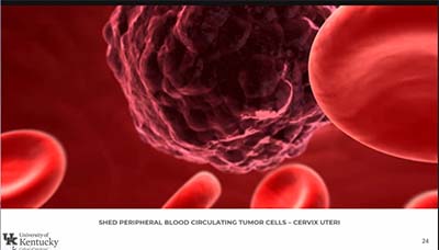 illustration of blood cells and tumor cells