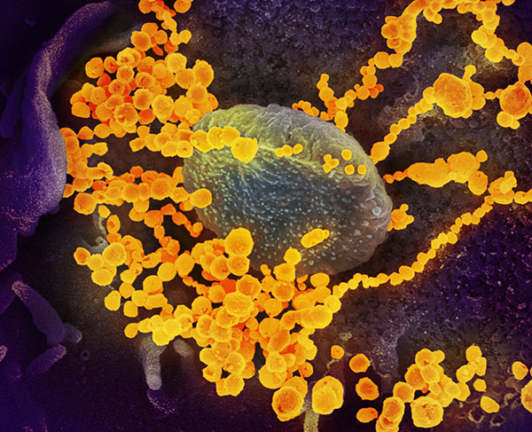 coronavirus particles (gold) emerging from an infected cell