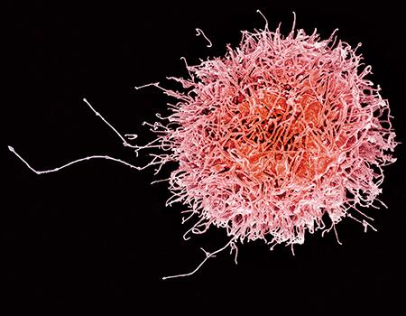 Colorized scanning electron micrograph of a natural killer cell from a human donor