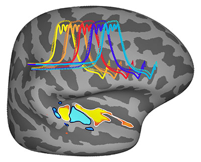 pitch processing in the brain