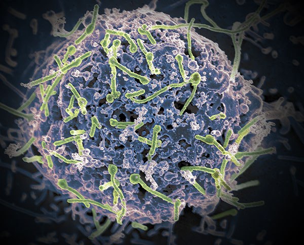 The Ebola virus (green) on the surface of a cell