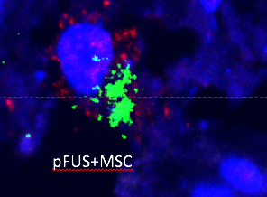 Mesencyhmal stromal cells (MSCs) releasing a therapeutic molecule called interleukin-10 (green) in a section of kidney tissue