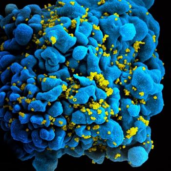 an HIV-infected T cell