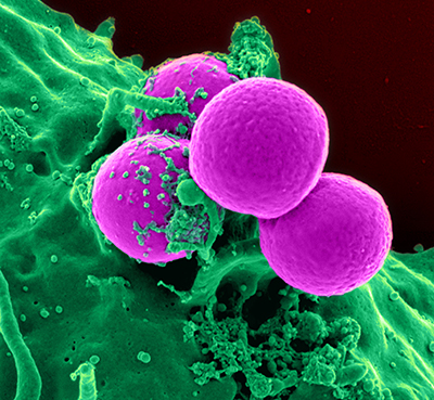 immune cells called neutrophils (purple) attacking bacteria