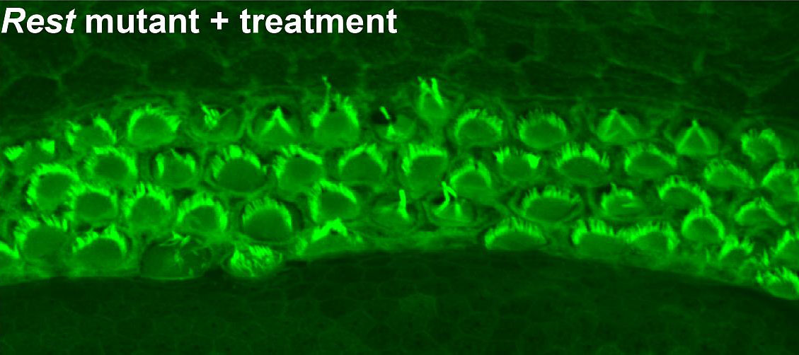 hair cells in treated mice with with a mutation that causes hearing loss