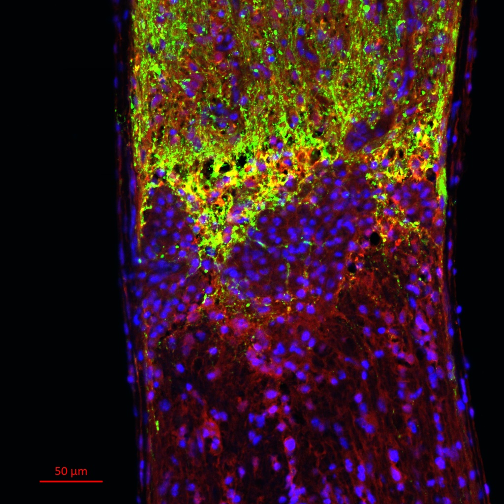 retinal ganglion cell axons after optic nerve crush injury