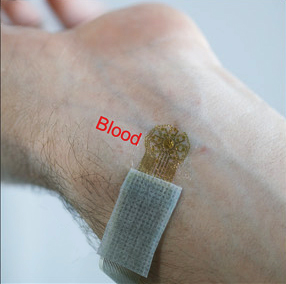 NIBIB researchers help design and test blood-flow sensor for vascular disease monitoring