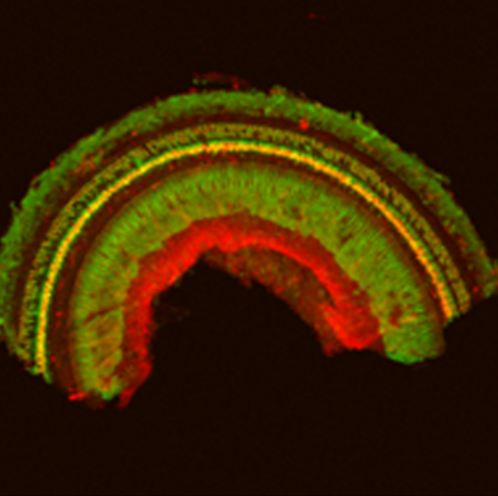 inner ear cells infected by a lab-designed virus with a gene that produces a glowing green protein