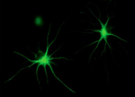 astrocytes