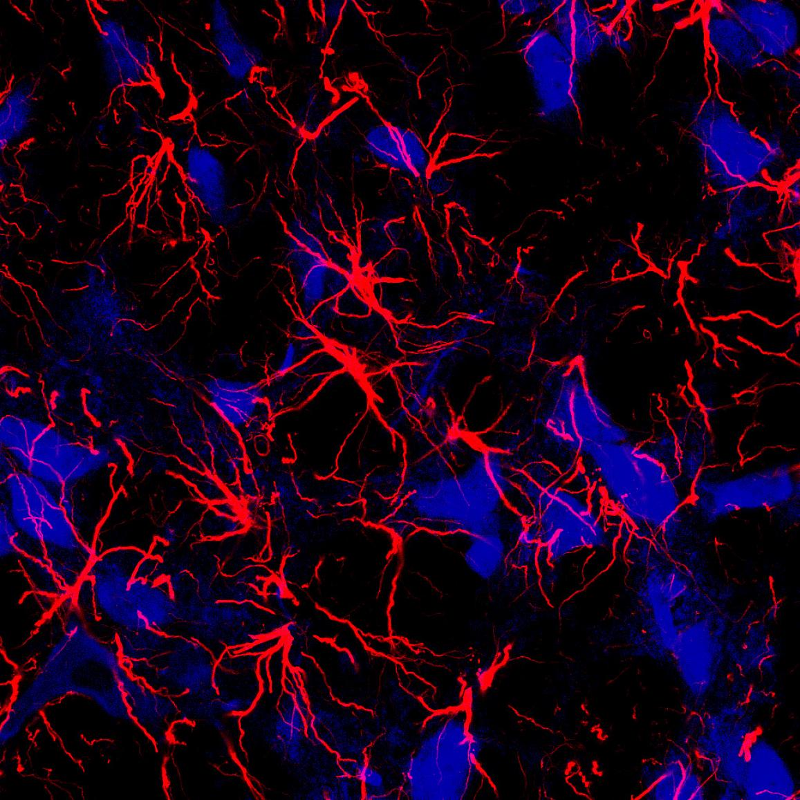 star-shaped brain cells called astrocytes