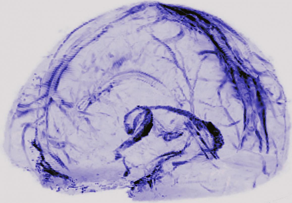 A brain drainage system - Brain scans of healthy volunteers showed that our brains may drain waste through lymphatic vessels, the body’s sewer system.