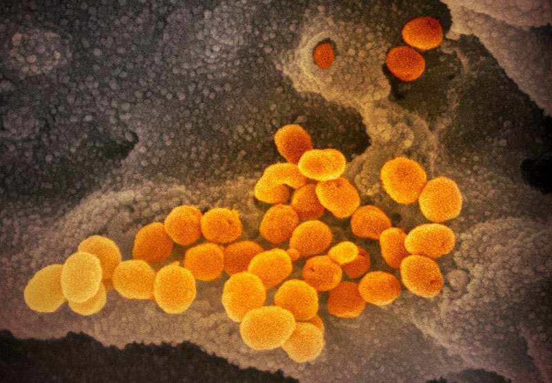 scanning electron microscope image shows SARS-CoV-2 (orange)—also known as 2019-nCoV, the virus that causes COVID-19—isolated from a patient in the U.S., emerging from the surface of cells (gray) cultured in the lab.