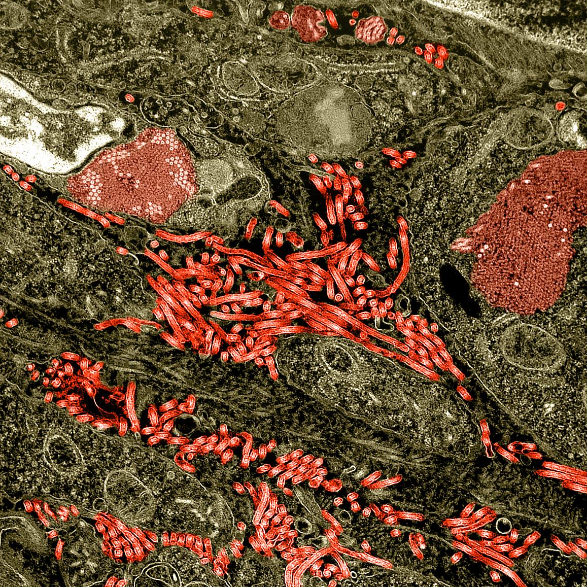 Colorized transmission electron micrograph of the ovary from a nonhuman primate infected with Ebola virus
