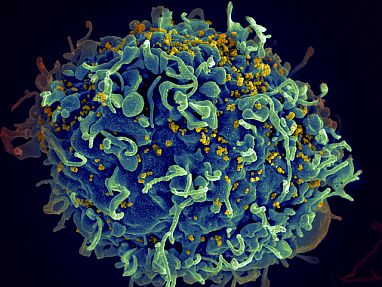 HIV-infected T cell