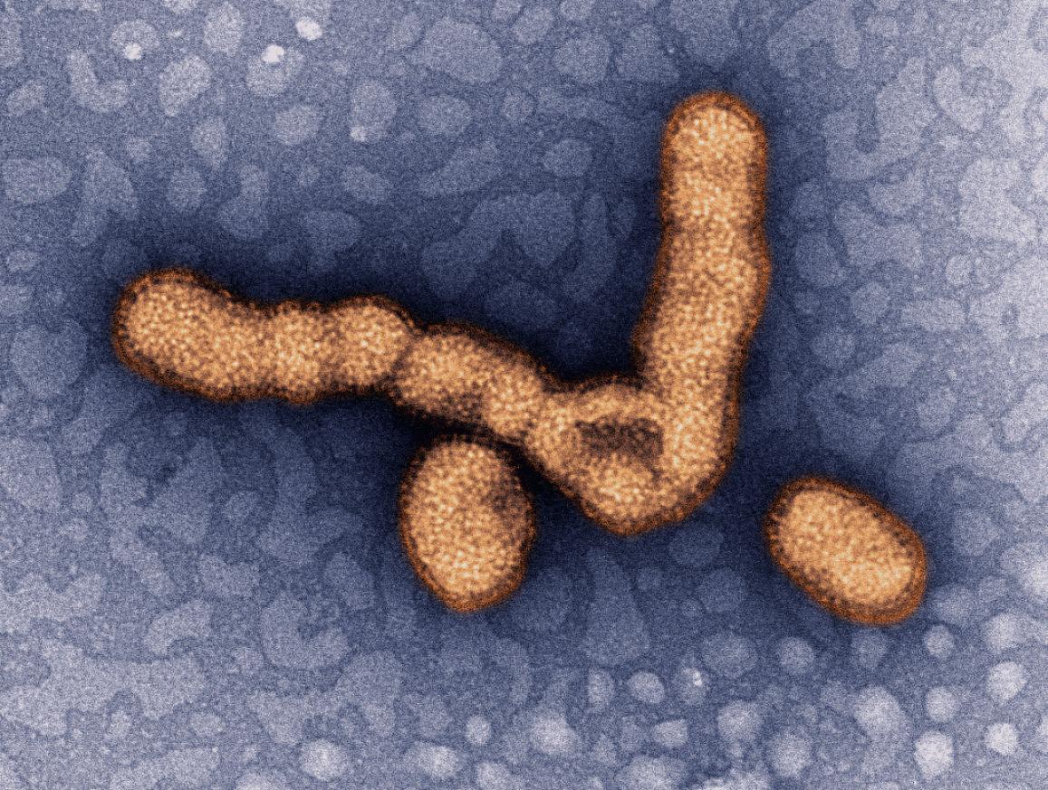 Colorized transmission electron micrograph showing H1N1 influenza virus particles