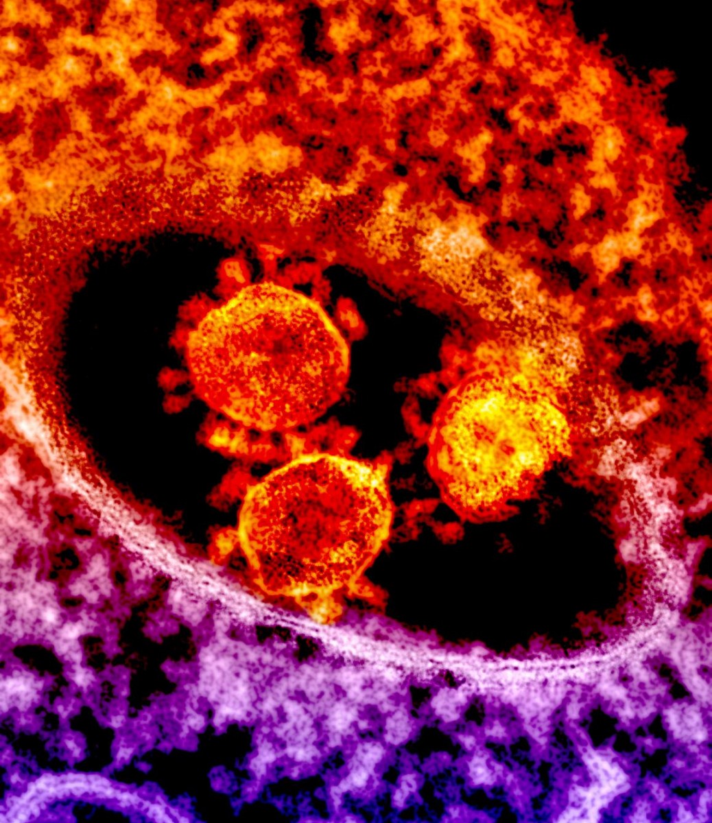 The round, spiked objects at center are MERS coronavirus particles.