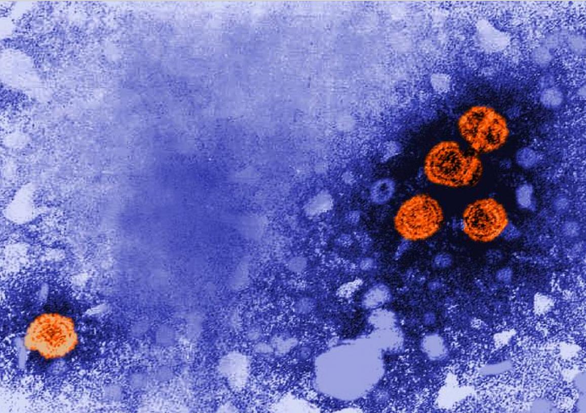 transmission electron microscope (TEM) image of the hepatitis B virus