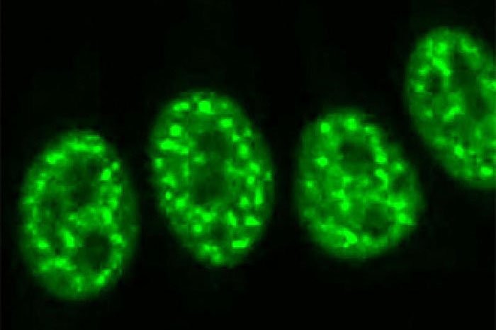 Immunofluorescent staining of human cells shows ANA as bright dots