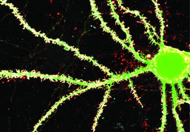 microscope image of a neuron