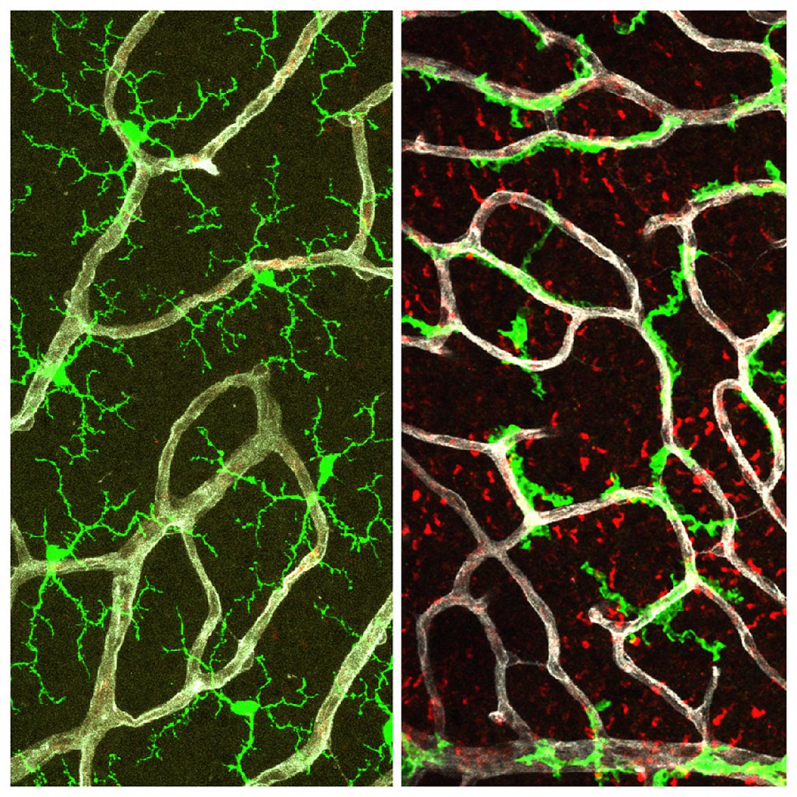 comparison of microglia in healthy retina vs retina without TGF-beta