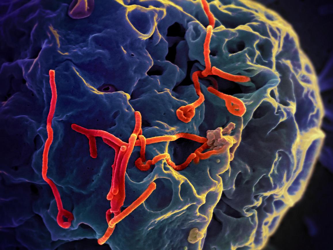 Ebola virus particles on a larger cell