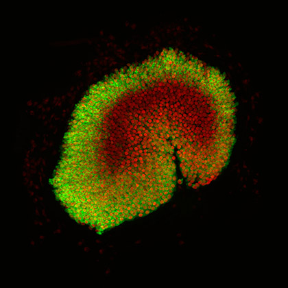 Scientists develop genetic blueprint of inner ear cell development