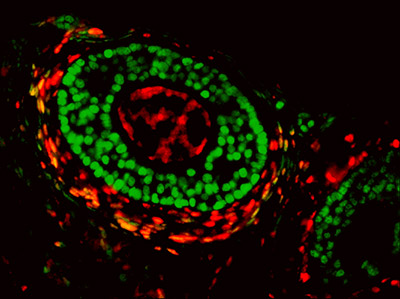 NIH study solves ovarian cell mystery, shedding new light on reproductive disorders