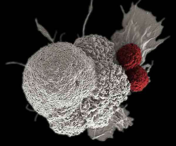 an immune cell (red) attacking a cancer cell (white)