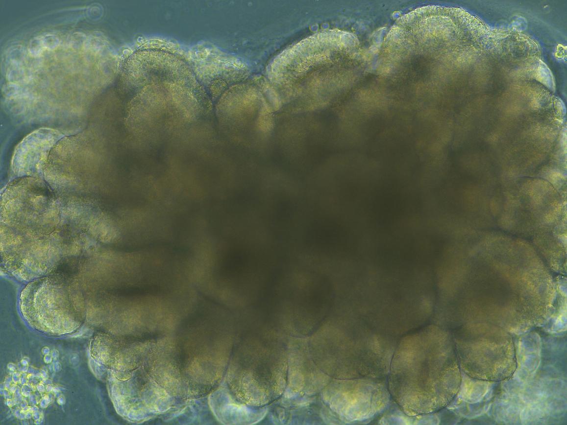 Brightfield microscope image of an organoid during development