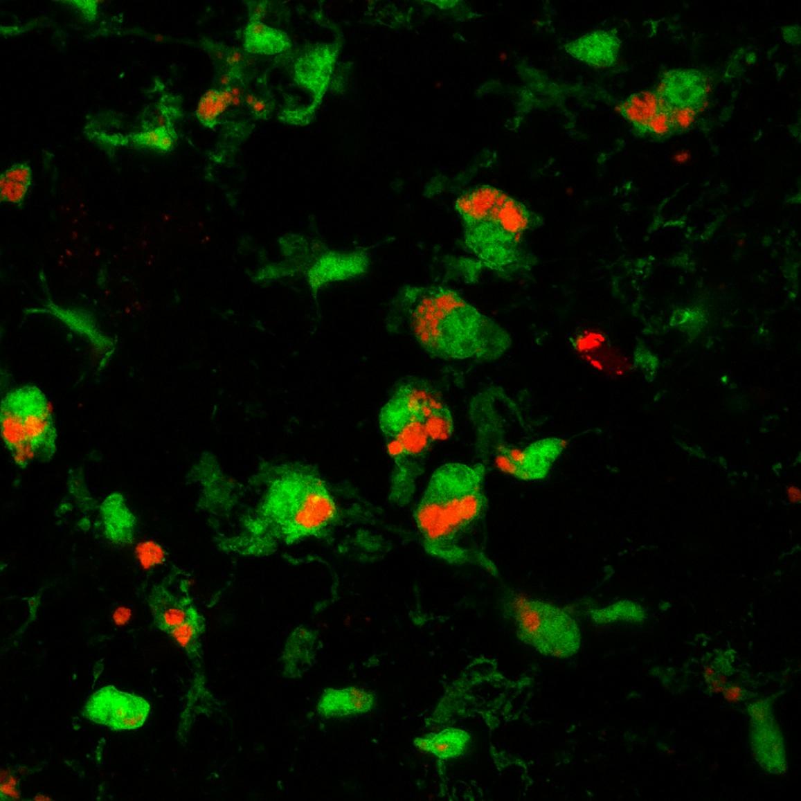 Microglial cells (green) engulfing and eliminating prion-damaged photoreceptors (red)