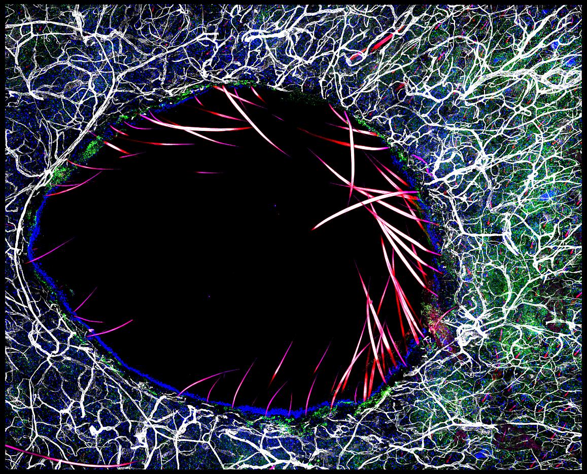 Immunofluorescent image of immune cells surrounding a skin wound, enriched in the beneficial bacteria S. epidermidis.