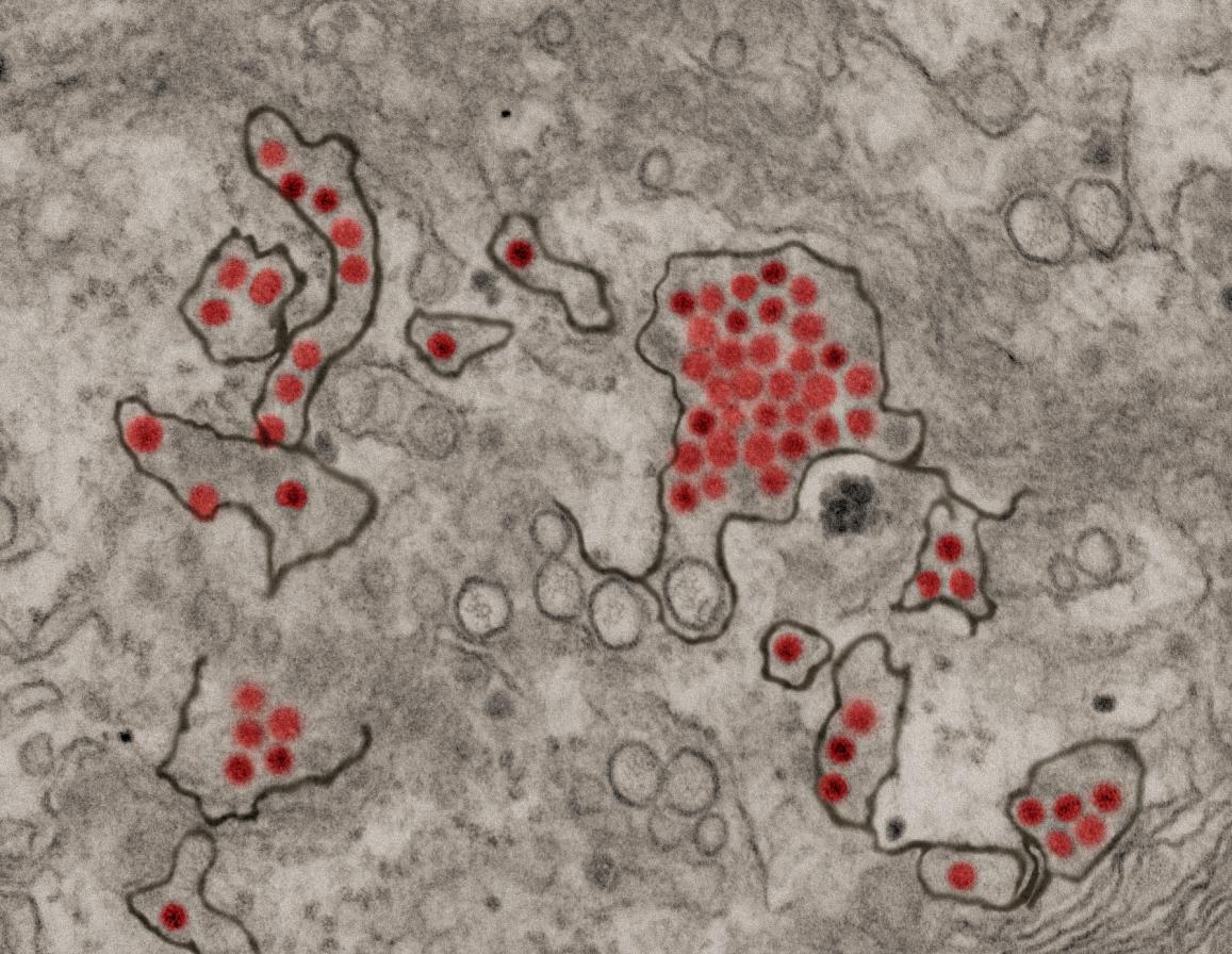 Zika virus particles (red) shown in African green monkey kidney cells.