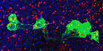 in fruit flies, the overexpression of the Cdk5-alpha gene caused the cell’s waste system to back up and trigger the immune system to attack dopamine neurons