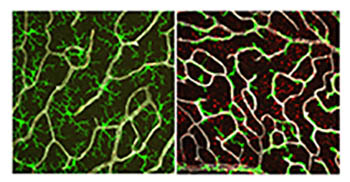 the one on left is green with squiggly shapes in it; the one on the right has reddish background with white squiggly shapes