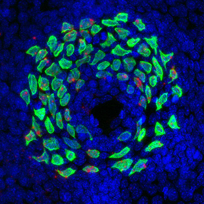 Merkel cells