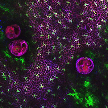 Langerhans cells